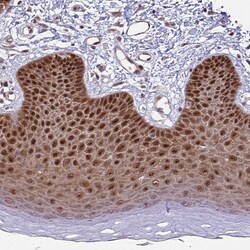 Invitrogen HSP40 Polyclonal Antibody 100 &mu;L | Buy Online | Invitrogen&trade; | Fisher Scientific