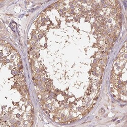 Invitrogen Tubulin alpha-1B Polyclonal Antibody 100 &mu;L; Unconjugated:Antibodies,