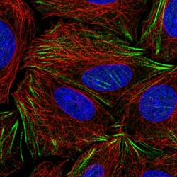 Invitrogen PDRG1 Polyclonal Antibody 100 &mu;L; Unconjugated:Antibodies,