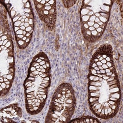 Invitrogen ITGA2 Polyclonal Antibody 100 &mu;L; Unconjugated:Antibodies,