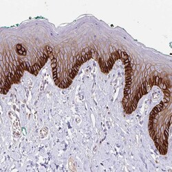 Invitrogen ITGA2 Polyclonal Antibody 100 &mu;L; Unconjugated:Antibodies,
