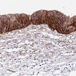 Invitrogen ITGA2 Polyclonal Antibody 100 &mu;L; Unconjugated:Antibodies,