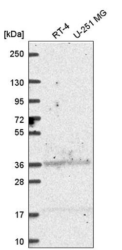 Invitrogen ALDH3A1 Polyclonal Antibody 100 &mu;L | Buy Online | Invitrogen&trade; | Fisher Scientific