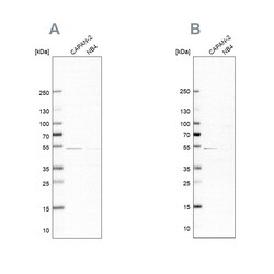 Invitrogen SPTLC1 Polyclonal Antibody 100 &mu;L | Buy Online | Invitrogen&trade; | Fisher Scientific