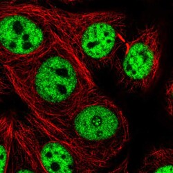 Invitrogen UBE4A Polyclonal Antibody 100 &mu;L; Unconjugated:Antibodies,