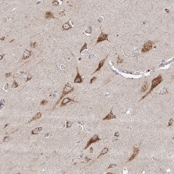 Invitrogen TM9SF4 Polyclonal Antibody 100 &mu;L; Unconjugated:Antibodies,