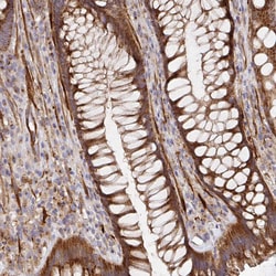 Invitrogen TM9SF4 Polyclonal Antibody 100 &mu;L; Unconjugated:Antibodies,