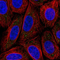 Invitrogen MED17 Polyclonal Antibody 100 &mu;L; Unconjugated:Antibodies,