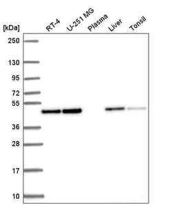 Invitrogen Annexin A7 Polyclonal Antibody 100 &mu;L; Unconjugated:Antibodies,
