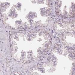 Invitrogen BLMH Polyclonal Antibody 100 &mu;L; Unconjugated:Antibodies,