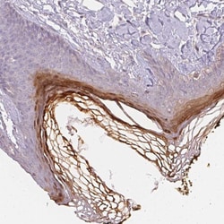 Invitrogen BLMH Polyclonal Antibody 100 &mu;L; Unconjugated:Antibodies,
