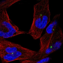 Invitrogen CEP290 Polyclonal Antibody 100 &mu;L; Unconjugated:Antibodies,