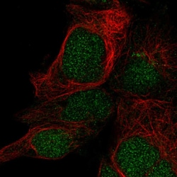 Invitrogen LYSMD1 Polyclonal Antibody 100 &mu;L; Unconjugated:Antibodies,
