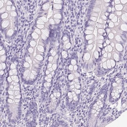 Invitrogen ATP6V0A4 Polyclonal Antibody 100 &mu;L; Unconjugated:Antibodies,