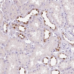 Invitrogen ATP6V0A4 Polyclonal Antibody 100 &mu;L; Unconjugated:Antibodies,