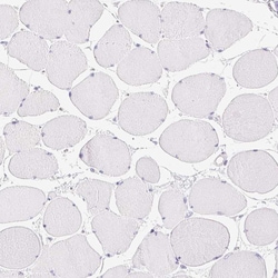 Invitrogen ATP6V0A4 Polyclonal Antibody 100 &mu;L; Unconjugated:Antibodies,
