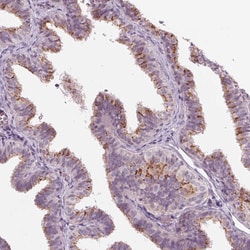 Invitrogen IL9R Polyclonal Antibody 100 &mu;L; Unconjugated:Antibodies,