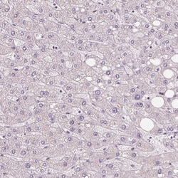 Invitrogen IL9R Polyclonal Antibody 100 &mu;L; Unconjugated:Antibodies,