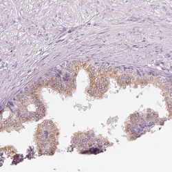 Invitrogen IL9R Polyclonal Antibody 100 &mu;L; Unconjugated:Antibodies,