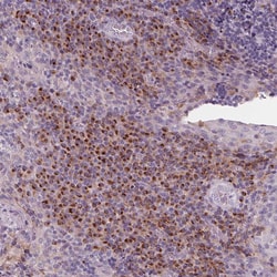 Invitrogen IL9R Polyclonal Antibody 100 &mu;L; Unconjugated:Antibodies,
