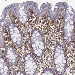Invitrogen EMILIN2 Polyclonal Antibody 100 &mu;L; Unconjugated:Antibodies,