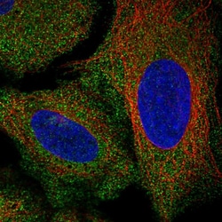 Invitrogen AKR7A2 Polyclonal Antibody 100 &mu;L; Unconjugated:Antibodies,