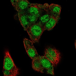 Invitrogen ChREBP Polyclonal Antibody 100 &mu;L; Unconjugated:Antibodies,