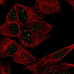 Invitrogen ATRX Polyclonal Antibody 100 &mu;L; Unconjugated:Antibodies,