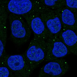 Invitrogen Synphilin 1 Polyclonal Antibody 100 &mu;L; Unconjugated:Antibodies,