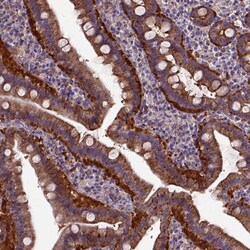 Invitrogen MVP Polyclonal Antibody 100 &mu;L | Buy Online | Invitrogen&trade; | Fisher Scientific
