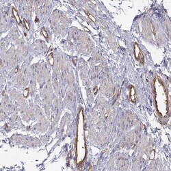 Invitrogen MYH9 Polyclonal Antibody 100 &mu;L; Unconjugated:Antibodies,