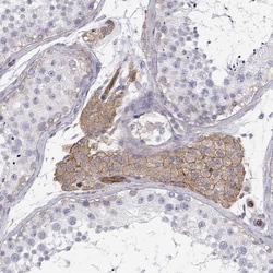 Invitrogen MYH9 Polyclonal Antibody 100 &mu;L; Unconjugated:Antibodies,