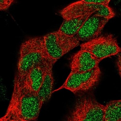 Invitrogen ZNF184 Polyclonal Antibody 100 &mu;L; Unconjugated:Antibodies,