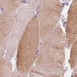 Invitrogen UGP2 Polyclonal Antibody 100 &mu;L | Buy Online | Invitrogen&trade; | Fisher Scientific