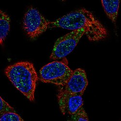 Invitrogen ACOX2 Polyclonal Antibody 100 &mu;L; Unconjugated:Antibodies,