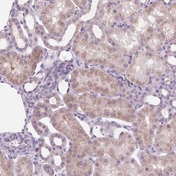 Invitrogen ACOX2 Polyclonal Antibody 100 &mu;L; Unconjugated:Antibodies,