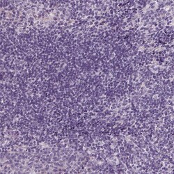 Invitrogen ACOX2 Polyclonal Antibody 100 &mu;L; Unconjugated:Antibodies,