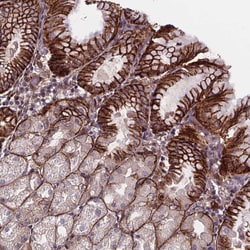 Invitrogen AEBP1 Polyclonal Antibody 100 μL; Unconjugated:Antibodies,