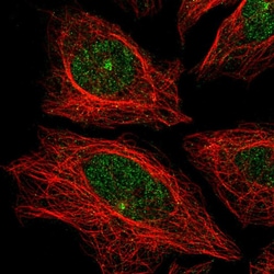 Invitrogen CDH24 Polyclonal Antibody 100 &mu;L; Unconjugated:Antibodies,