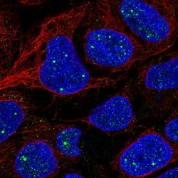 AMER1 Polyclonal Antibody:Antibodies, Polyclonal