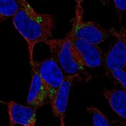 CTRP3 Polyclonal Antibody:Antibodies, Polyclonal