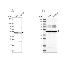 Invitrogen HADHB Polyclonal Antibody 100 &mu;L; Unconjugated:Anticuerpos