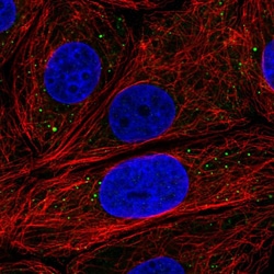 Invitrogen EDC3 Polyclonal Antibody 100 &mu;L; Unconjugated:Antibodies,