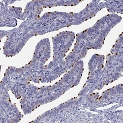 Invitrogen CCDC11 Polyclonal Antibody 100 &mu;L; Unconjugated:Antibodies,