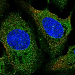 LDHD Polyclonal Antibody:Antibodies, Polyclonal