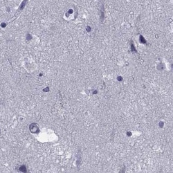 Invitrogen GKAP1 Polyclonal Antibody 100 &mu;L; Unconjugated:Antibodies,