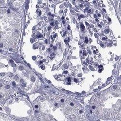 Invitrogen GKAP1 Polyclonal Antibody 100 &mu;L; Unconjugated:Antibodies,