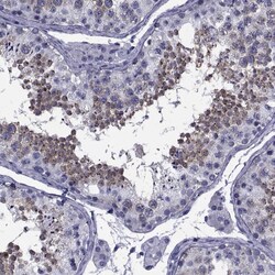 Invitrogen GKAP1 Polyclonal Antibody 100 &mu;L; Unconjugated:Antibodies,