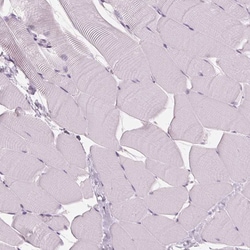 DNase II Polyclonal Antibody:Antibodies, Polyclonal