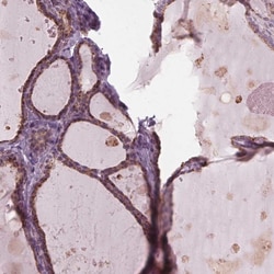 DNase II Polyclonal Antibody:Antibodies, Polyclonal